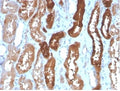 IHC staining of FFPE human kidney tissue with FABP3 antibody (clone FABP3/3430) HIER: boil tissue sections in pH 9 10mM Tris with 1mM EDTA for 20 min and allow to cool before testing.