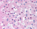 IHC testing of FFPE human liver with C14orf68 antibody at 2.5ug/ml. HIER: steamed with pH6 citrate buffer, AP-staining.