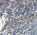 Western blot testing of 1ng of human recombinant protein with VCAM1 antibody at 0.5ug/ml. Expected molecular weight: 74-110 kDa depending on glycosylation level.