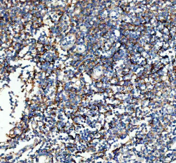 Western blot testing of 1ng of human recombinant protein with VCAM1 antibody at 0.5ug/ml. Expected molecular weight: 74-110 kDa depending on glycosylation level.