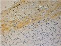 IHC testing of FFPE mouse brain with JIP3 antibody at 4ug/ml. HIER: steamed with pH6 citrate buffer, HRP-staining.