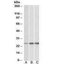 Western blot testing of human [A], mouse [B] and rat [C] skeletal muscle lysate with TNNI2 antibody at 0.03ug/ml. Predicted molecular weight: ~21kDa, observed here at ~25kDa.
