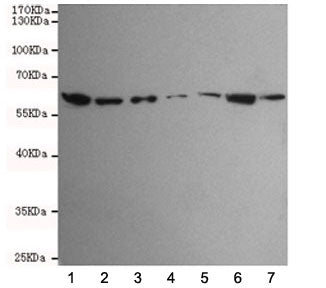Western blot testing of human 1) HCT116, 2) SW480, 3) HepG2, 4) A549, 5) Jurkat, 6) K562 and 7) HeLa cell lysates using TAB1 antibody at 1:1000. Predicted molecular weight ~55 kDa.