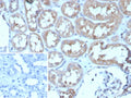 IHC staining of FFPE human kidney tissue with ADCY8 antibody (clone ADCY8/7573). Inset: PBS used in place of primary Ab (secondary Ab negative control). HIER: boil tissue sections in pH 9 10mM Tris with 1mM EDTA for 20 min and allow to cool before testing.