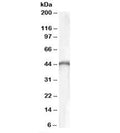 Western blot testing of human brain lysate with brain Creatine Kinase antibody at 0.1ug/ml. Predicted molecular weight: ~43 kDa.