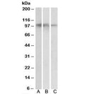 Western blot testing of human hippocampus [A], cerebral cortex [B] and cerebellum [C] lysates with NTRK2 antibody at 0.05ug/ml. Expected molecular weight: 90~140 kDa, depending on glycosylation level.