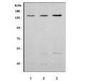 Western blot testing of human 1) HeLa, 2) A549 and 3) PC-3 cell lysate with Neuropilin 1 antibody. Expected molecular weight: 102-130 kDa.