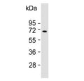 Western blot testing of human Ramos cell lysate with KNG1 antibody. Predicted molecular weight ~72 kDa.