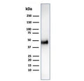 Western blot testing of human HCT-116 cell lysate using recombinant CCNE1 antibody (clone CCNE1/4935R). Predicted molecular weight ~47 kDa.