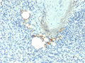 TRAcP Antibody Spleen IHC Macrophage Staining. Immunohistochemistry analysis of Tartrate-resistant acid phosphatase / ACP5 in FFPE human spleen tissue using TRAcP Antibody for IHC. HRP-DAB brown chromogenic staining highlights scattered macrophage-lineage cells within splenic tissue, with cytoplasmic localization consistent with lysosomal enzyme expression, while surrounding lymphoid cells remain largely negative.