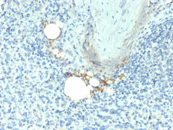 TRAcP Antibody Spleen IHC Macrophage Staining. Immunohistochemistry analysis of Tartrate-resistant acid phosphatase / ACP5 in FFPE human spleen tissue using TRAcP Antibody for IHC. HRP-DAB brown chromogenic staining highlights scattered macrophage-lineage cells within splenic tissue, with cytoplasmic localization consistent with lysosomal enzyme expression, while surrounding lymphoid cells remain largely negative.
