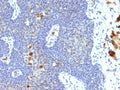 IHC staining of FFPE human cervix tissue with HPV-16 antibody (clone 4B12). Inset: PBS used in place of primary Ab (secondary Ab negative control). HIER: boil tissue sections in pH 9 10mM Tris with 1mM EDTA for 20 min and allow to cool before testing.