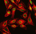 Immunofluorescent staining of DKC1 using anti-DKC1 antibody (green) and anti-Beta Tubulin antibody (red). DKC1 was detected in an immunocytochemical section of human U2OS cells. Enzyme antigen retrieval was performed using IHC enzyme antigen retrieval reagent for 15 mins. The cells were blocked with 10% goat serum. And then incubated with 5 ug/ml rabbit anti-DKC1 antibody and mouse anti-Beta Tubulin antibody overnight at 4oC.