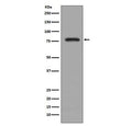 Western blot testing of human K562 cell lysate with PKC beta 2 antibody. Predicted molecular weight ~77 kDa.