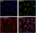 IF/ICC staining of mouse NIH3T3 cells with Beta Tubulin antibody (red), PCNA antibody (green) and DAPI nuclear stain (blue).