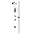 Western blot testing of human placental tissue lysate with HPGD antibody. Predicted molecular weight ~29 kDa.