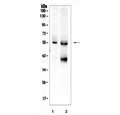 Western blot testing of human 1) HeLa and 2) SW579 cell lysate with TGFBR1 antibody. Expected molecular weight ~55 kDa.