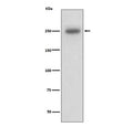 Western blot testing of human A431 cell lysate with LAMB1 antibody. Predicted molecular weight ~198 kDa, observed at 220-240 kDa.