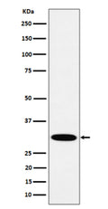 Western blot analysis of HMGCL expression in human A431 cell lysate using HMGCL antibody. Predicted molecular weight ~34 kDa.