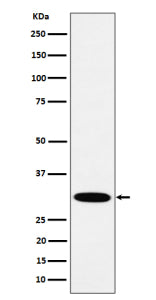 Western blot analysis of HMGCL expression in human A431 cell lysate using HMGCL antibody. Predicted molecular weight ~34 kDa.