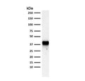 Western blot testing of human PC3 cell lysate with AMACR antibody. Predicted molecular weight ~43 kDa.