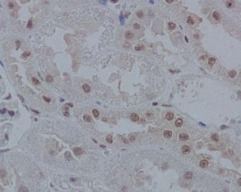 IHC staining of FFPE rat kidney tissue with IRF1 antibody. HIER: boil tissue sections in pH6, 10mM citrate buffer, for 10-20 min and allow to cool before testing.