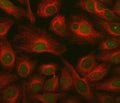 Immunofluorescent staining of FFPE human HeLa cells with ING2 antibody (green) and Beta Tubulin mAb (red). HIER: steam section in pH6 citrate buffer for 20 min.