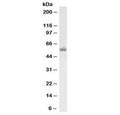 Western blot testing of human testis lysate with LCAT antibody at 1ug/ml. Observed molecular weight: 50~75 kDa depending on glycosylation level.