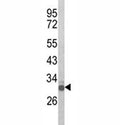 Western blot analysis of Olig3 antibody and mouse spleen tissue lysate