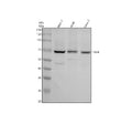 Western blot analysis of PAK4 using anti-PAK4 antibody. Electrophoresis was performed on a 10% SDS-PAGE gel at 80V (Stacking gel) / 120V (Resolving gel) for 2 hours. Lane 1: human MCF-7 whole cell lysates, Lane 2: human whole cell lysates, Lane 3: human Caco-2 whole cell lysates. After electrophoresis, proteins were transferred to a nitrocellulose membrane at 150 mA for 50-90 min. Blocked the membrane with 5% non-fat milk/TBS for 1.5 hour at RT.