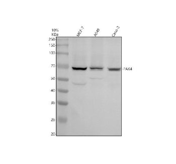 Western blot analysis of PAK4 using anti-PAK4 antibody. Electrophoresis was performed on a 10% SDS-PAGE gel at 80V (Stacking gel) / 120V (Resolving gel) for 2 hours. Lane 1: human MCF-7 whole cell lysates, Lane 2: human whole cell lysates, Lane 3: human Caco-2 whole cell lysates. After electrophoresis, proteins were transferred to a nitrocellulose membrane at 150 mA for 50-90 min. Blocked the membrane with 5% non-fat milk/TBS for 1.5 hour at RT.