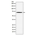 Western blot testing of human Jurkat cell lysate with PDC-E2 antibody. Predicted molecular weight ~69 kDa.