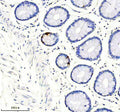 SST Antibody / Somatostatin