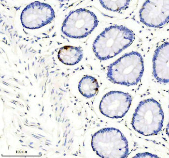 SST Antibody / Somatostatin