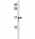 TRAPPC2 antibody western blot analysis in NCI-H292 lysate.