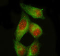 Immunofluorescent staining of PDX1 using anti-PDX1 antibody (red) and anti-Beta Tubulin antibody (green). PDX1 was detected in immunocytochemical section of HELA cell. Enzyme antigen retrieval was performed using IHC enzyme antigen retrieval reagent for 15 mins. The cells were blocked with 10% goat serum. And then incubated with 5 ug/ml rabbit anti-PDX1 antibody and mouse anti-Beta Tubulin antibody overnight at 4oC.