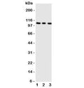 Western blot testing of ADAMTS1 antibody; Lane 1: rat liver; 2: (r) heart; 3: (r) brain tissue lysate. Predicted molecular weight 84~120 kDa depending on glycosylation and processing.