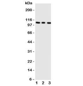 Western blot testing of ADAMTS1 antibody; Lane 1: rat liver; 2: (r) heart; 3: (r) brain tissue lysate. Predicted molecular weight 84~120 kDa depending on glycosylation and processing.