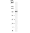 Western blot testing of human liver lysate with SHP-1 antibody at 0.1ug/ml. Predicted molecular weight: ~68kDa.