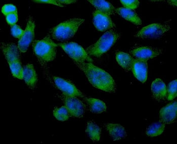 Immunofluorescent staining of FFPE human U-2 OS cells with ARA9 antibody (green) at 2ug/ml and DAPI nuclear stain (blue). HIER: steam section in pH6 citrate buffer for 20 min.