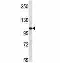 TLR8 antibody western blot analysis in mouse bladder tissue lysate. Expected molecular weight ~120 kDa.