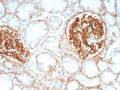 IHC staining of FFPE human kidney tissue with CD29 antibody (clone ITGB1/8744R). HIER: boil tissue sections in pH 9 10mM Tris with 1mM EDTA for 20 min and allow to cool before testing.