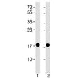 Western blot testing of 1) human brain and 2) mouse brain lysate with SNCA antibody at 1:2000. Predicted molecular weight ~15 kDa.
