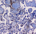IHC testing of FFPE human placental tissue with ITGA5 antibody. Required HIER: steam section in pH6 citrate buffer for 20 min and allow to cool prior to testing.