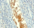 Formalin-fixed, paraffin-embedded human tonsil stained with AMPD3 antibody (clone ETAD3-1).