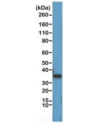 Western blot testing of human HeLa cell lysate with recombinant Cyclin D1 antibody at 1:1000. Predicted molecular weight: 32-36 kDa.