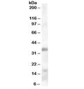 Western blot testing of human tonsil lysate with TIM-3 antibody at 0.3ug/ml. Expected molecular weight: 33-70 kDa depending on glycosylation level.