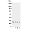 Western blot testing of Interferon gamma antibody and Lane 1: recombinant human protein 10ng; 2: 5ng; 3. 2.5ng; 4: 1.25ng