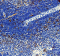 Western blot testing of IL-3 antibody and Lane 1: Recombinant human IL-3 protein 10ng; 2: 5ng; 3: 2.5ng