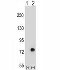 Western blot analysis of TGFBI antibody and 293 cell lysate either nontransfected (Lane 1) or transiently transfected (2) with the TGFBI gene.